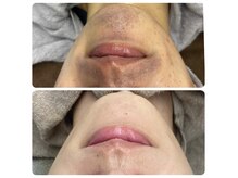 ビラ ベルダ(Bira Beldad)の雰囲気（結果が違う脱毛☆男性の髭脱毛もご相談ください。）