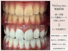 ホワイト(WHITE)/通い放題3ヶ月継続コース★WHITE