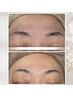 【最強小顔&艶肌水光肌へ♪】最新小顔マシンテラボーラー&WAXスキンケア脱毛