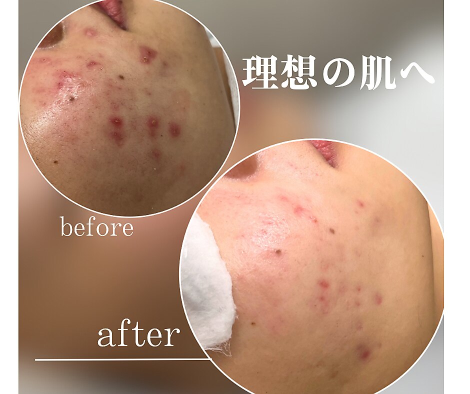 モモ(Momo.)｜ホットペッパービューティー