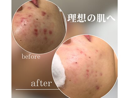 モモ(Momo.)の写真