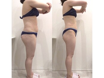 リラパドマ 千葉店(Rela Padma)/激痩せ短期集中ダイエットコース