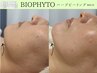 ハリ弾力毛穴【たるみ改善コース】デコルテケア+ホームケア3日分