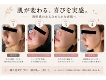 ヴァニーユ(Vanille)の雰囲気（肌本来の美しさを引き出し、理想の素肌へ★）