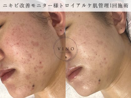 ヴィノ フクシマ(VINO FUKUSHIMA)の写真