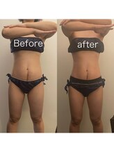 アイアム(I am)/細身の方でもきちんと効果◎