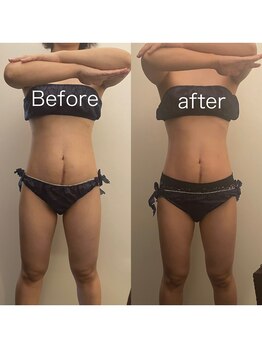 アイアム(I am)/細身の方でもきちんと効果◎