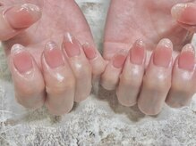 ヴィプラス(Vi+)/