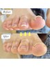 【巻き爪緩和】巻き爪.陥入爪.爪の形が気になる