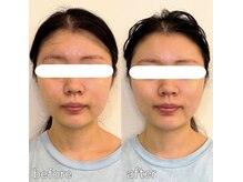 整え屋 レッド(RED)/阿波座/本町/小顔矯正/美容整体