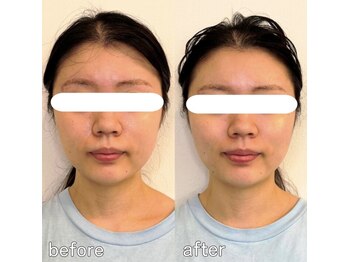 整え屋 レッド(RED)/阿波座/本町/小顔矯正/美容整体