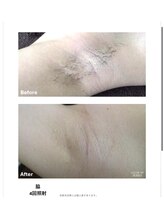 リネ(Rine)/【before→after】