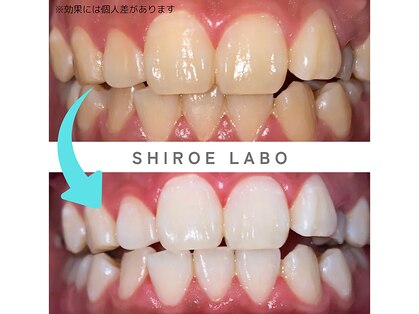 ホワイトニングショップ 梅田店の写真