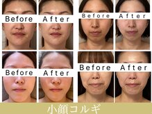 アンシャンテ(Enchant)