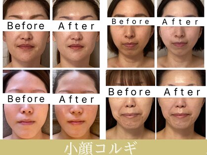 アンシャンテ(Enchant)の写真