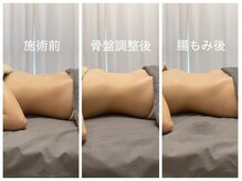 カナロア(Kanaloa)/腸もみ×骨盤調整 痩身/便通改善