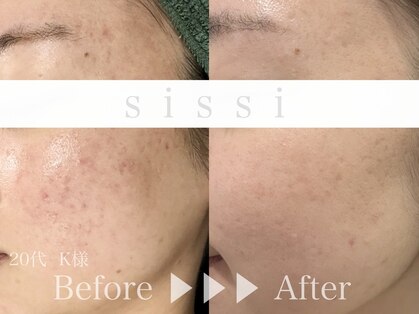 シシィ 二子玉川(sissi)の写真