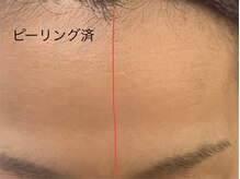 ポマイカイ 名古屋丸の内店(pomaikai)/ハイドロフェイシャル