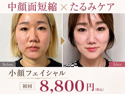ソワラ 札幌の写真