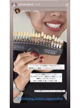 ホワイトニングビューティー 名古屋栄店(WHITENING BEAUTY)/セルフホワイトニング