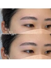 フレイズラピス(FRASE Lapis)/【ハリウッドブロウリフト】