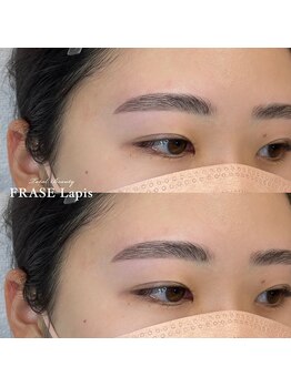 フレイズラピス(FRASE Lapis)/【ハリウッドブロウリフト】