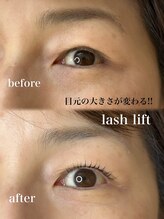 ノエル(Noel)/before→after 担当なぎ