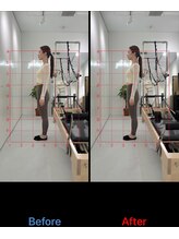 ピラティスエルエー(pilates LA)/たった1回のビフォーアフター