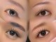 ベルミー(BellMe)の写真