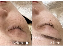 アリエルリッチ/シミ【美肌ケア】