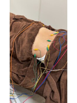 はりの門 神谷町 虎ノ門/痺れる!!感覚の異変に鍼通電施術