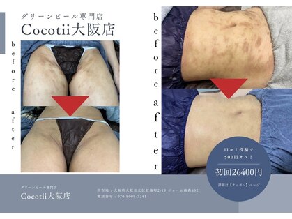ココティー 大阪店(Cocotii)の写真
