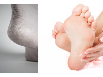 ネイルサロン マリキータ(MARIQUITA)の写真/足元まるごと整う。角質ケア×爪の長さ形を整えるトータルケア『フットプレミアム角質ケア/4570』