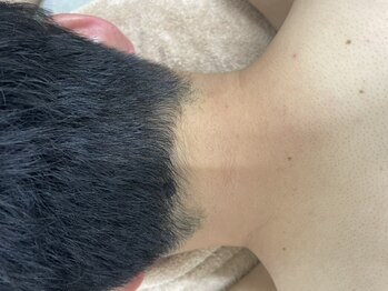 ナノハナ/鹿沼市の全身脱毛美容室ナノハナ