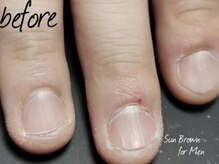サンブラウン(SUN BROWN)/Men’s nail care -before-