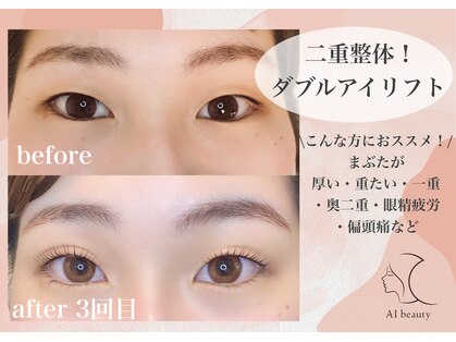 アイビューティー(AI beauty)の写真