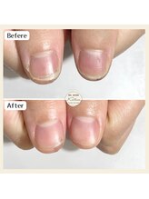 カロッス(Kallos)/ネイルケア