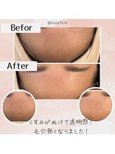 リュクス  Luxe＋tkm 南船場/最新第4世代/ララピール