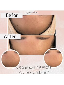 リュクス  Luxe＋tkm 南船場/最新第4世代/ララピール