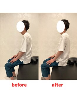 ナオル整体 福岡香椎院(NAORU整体)/50代男性施術事例【猫背】