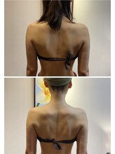 アニバーサリー(Anniversary)/ブライダルエステ