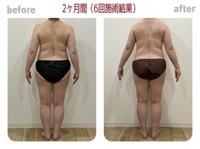 ピエルクララ(Piel clara)の雰囲気（集中ケアで驚きの結果！足先から頭までの本当の全身リンパケア！）