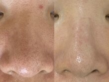 リードスラッシュ(LEAD/)/プロセルセラピーズお顔