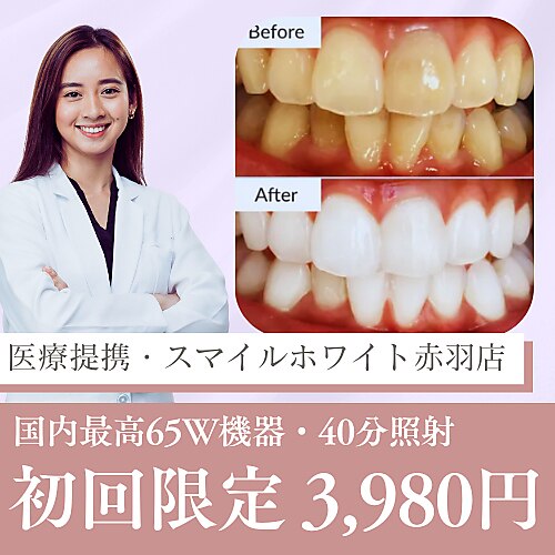 【医療提携】ホワイトニングメニュー導入　単品可 クーポン・メニュー｜スマイルホワイト 赤羽店｜ホットペッパー