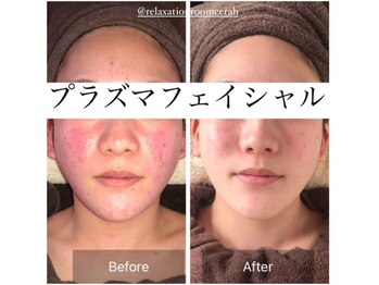 リラクゼーションルーム チュラ(Relaxation Room CERAH)/