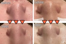 ベベ 金沢片町店(Be’be’)