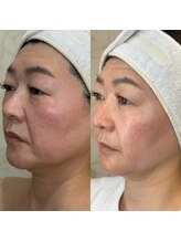 エヴェリーナ(Eveliiina)/ホワイトスノーピール