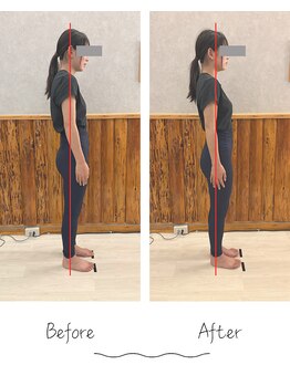 トータルボディケア モフ(Total Body Care Moff)/美姿勢プログラム施術例