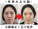 【小顔・小顔矯正専門店】BUPURA|ブプラ江坂店の写真