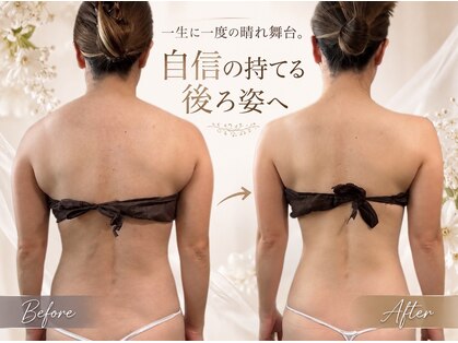 サロンハート(Salon Heart)の写真